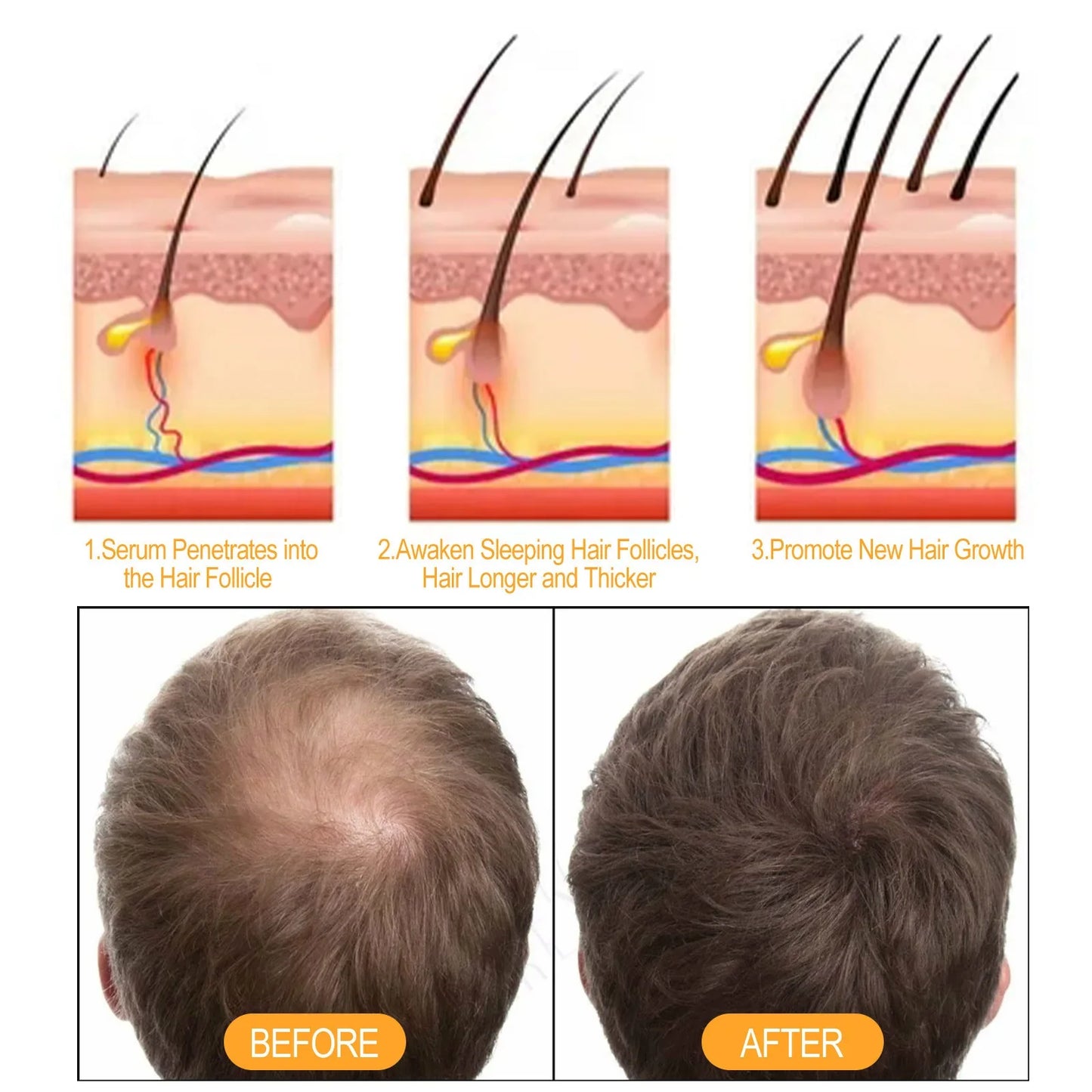 EELHOE Ginger Anti Hair Loss Shampoo – Strengthen & Repair