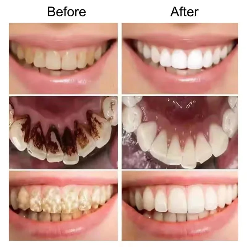 V34 Purple Teeth Whitening Toothpaste Remove Plaque Stains Cleaning Oral Hygiene Dental Bleach Tools Fresh Breath Beauty Health Peaceful Pleasures Health and Wellness