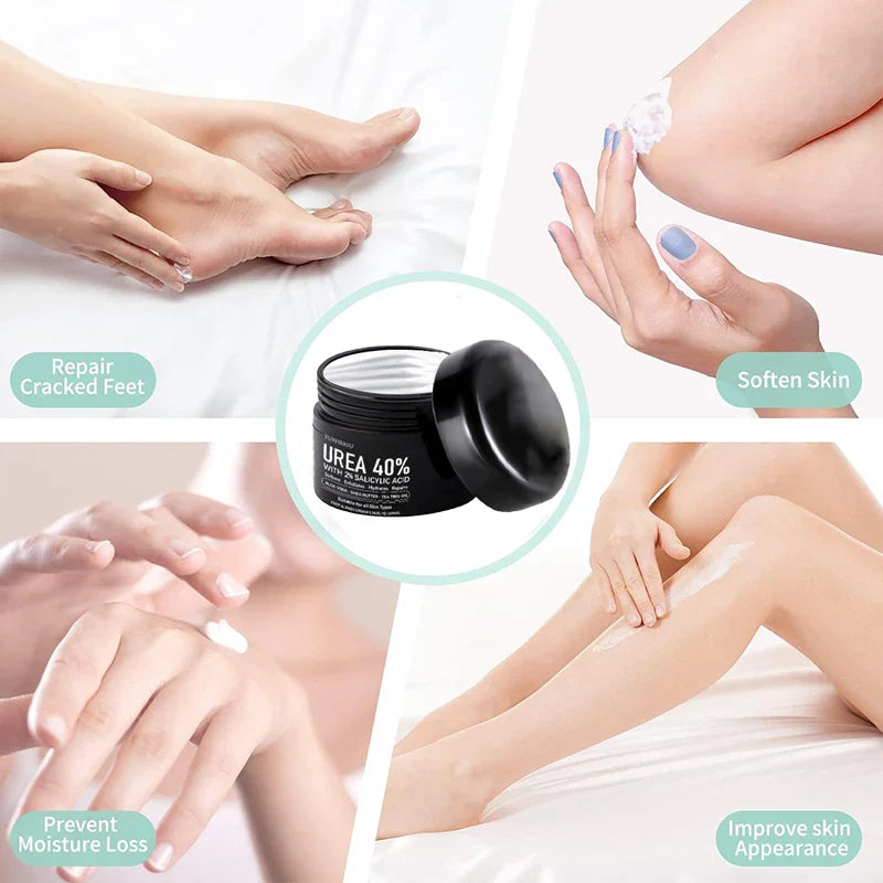 YURHERSU 40% Urea Foot Cream – Deep Moisturizing Heel Repair
