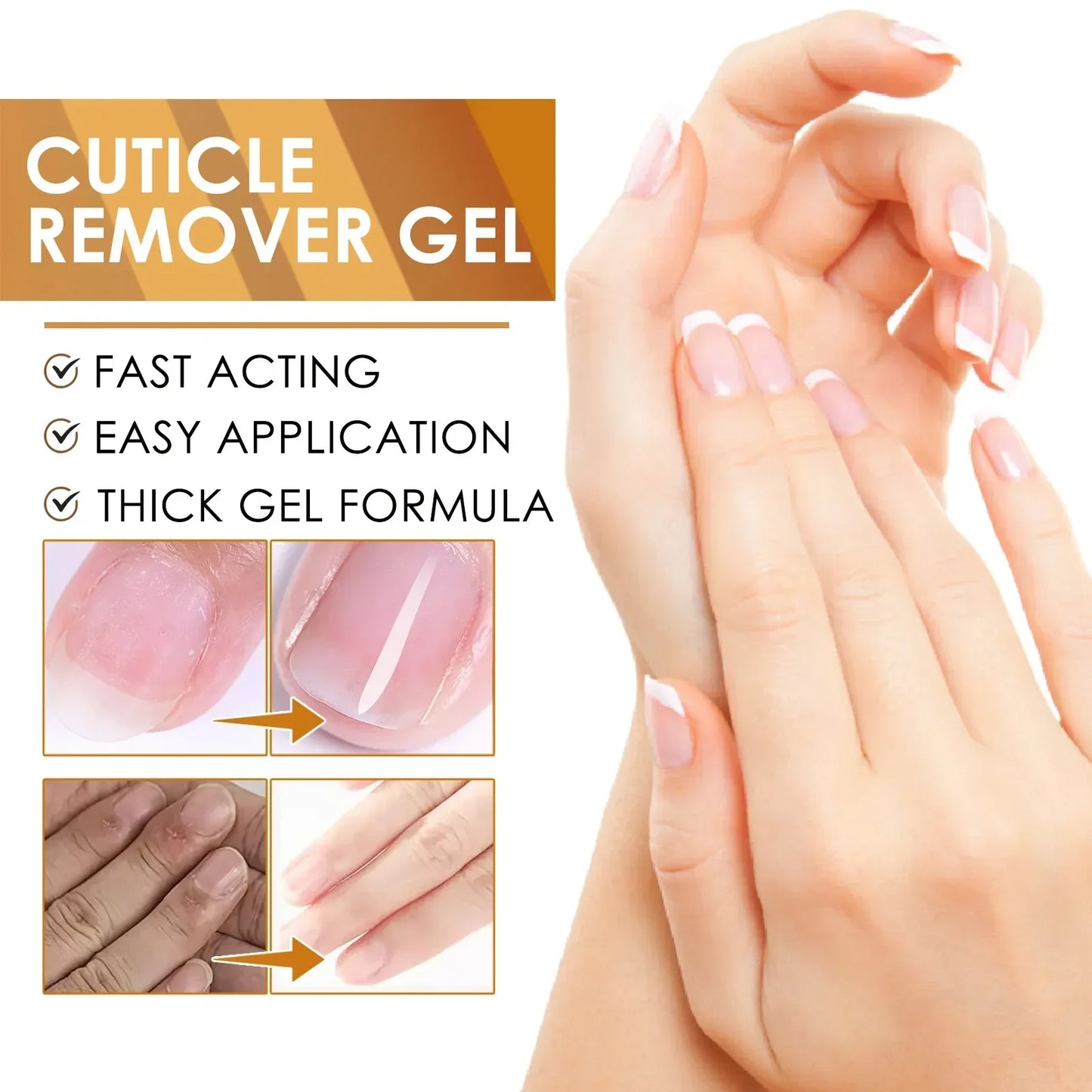 EELHOE Cuticle Removal Gel – Nail Softener & Dead Skin Remover
