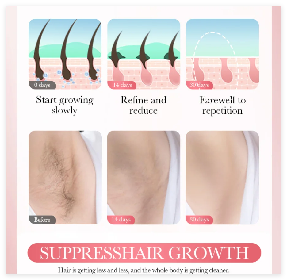 SADOER 3-Min Hair Removal Cream | Face, Body & Intimate Areas