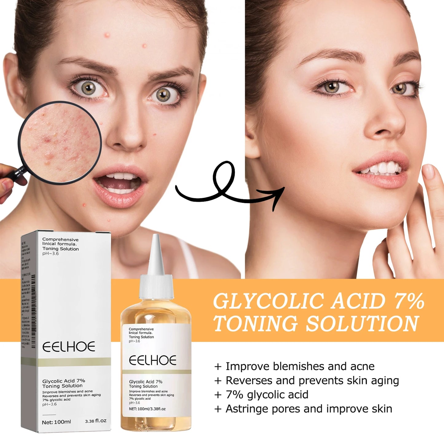 Eelhoe 7% Glycolic Acid Toner – Acne, Brightening & Anti-Aging