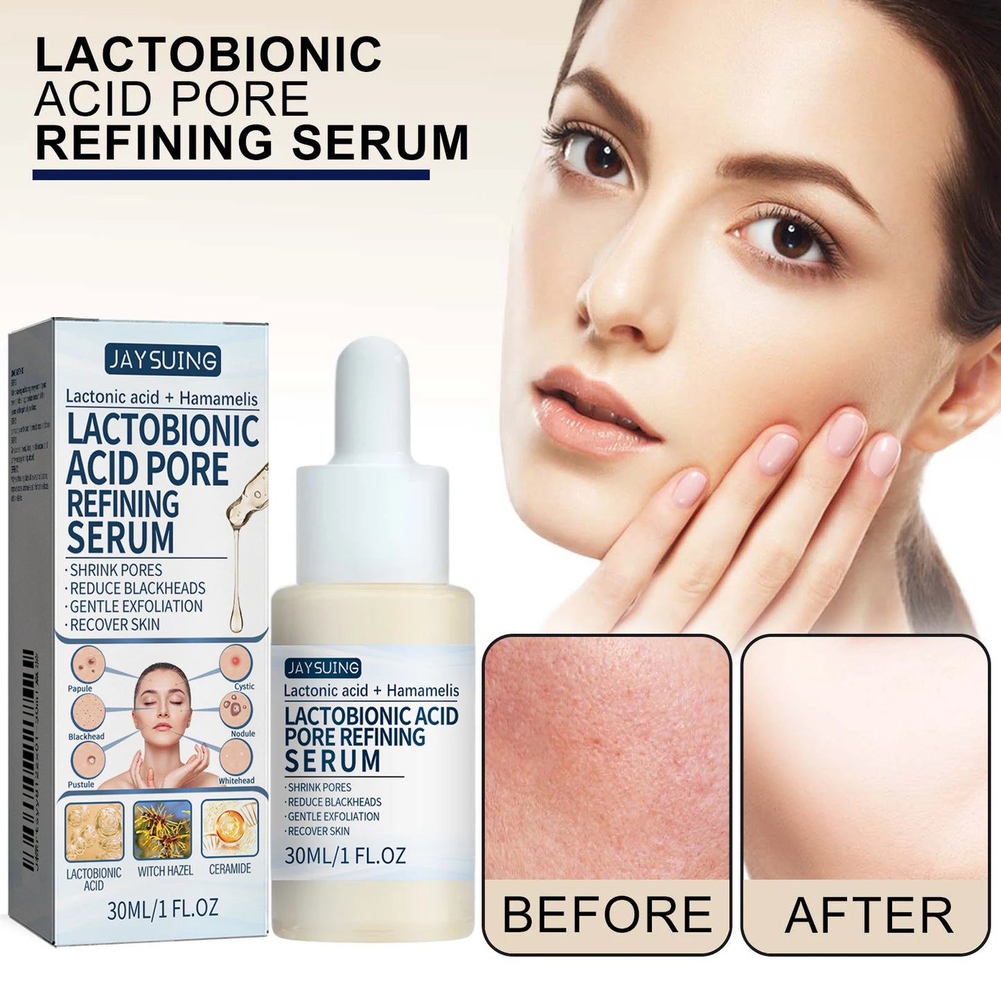 Lactic Acid Essence – Blackhead Removal & Pore Tightening Serum