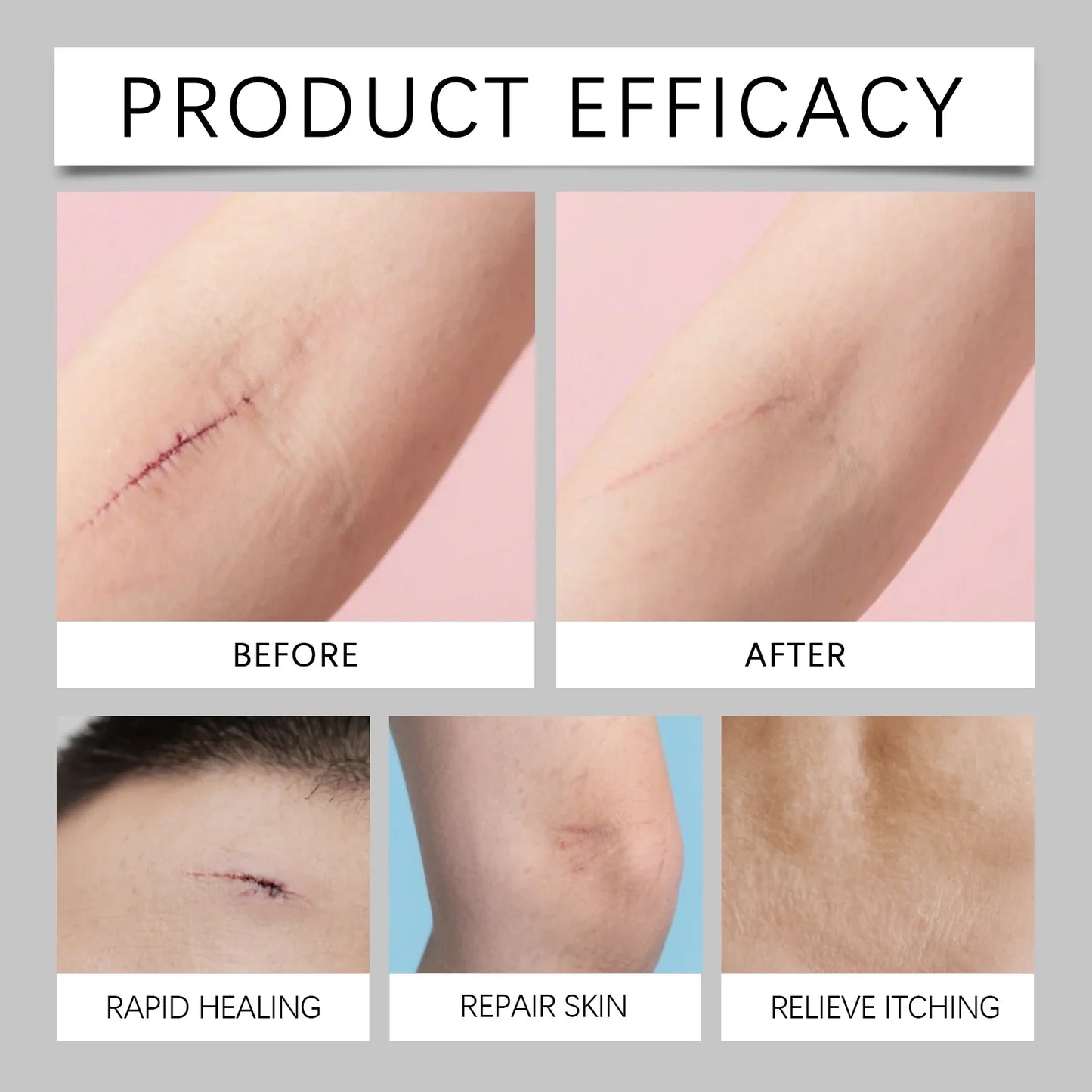 Scar Care Moisturizing Stick – Hydrating Balm Face & Body