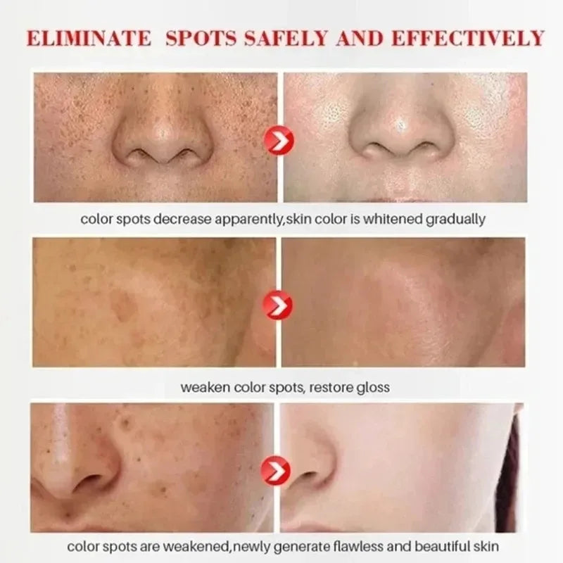 Niacinamide Whitening Freckle Cream – Dark Spot Fader Peaceful Pleasures Health and Wellness