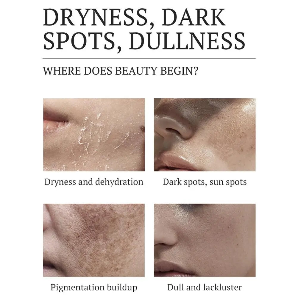 Brightening Dark Spot Corrector Cream 20g Salicylic Acid Amino Acid Formula, Fades Pigmentation Melasma, Refines Pores 1/5pcs Peaceful Pleasures Health and Wellness