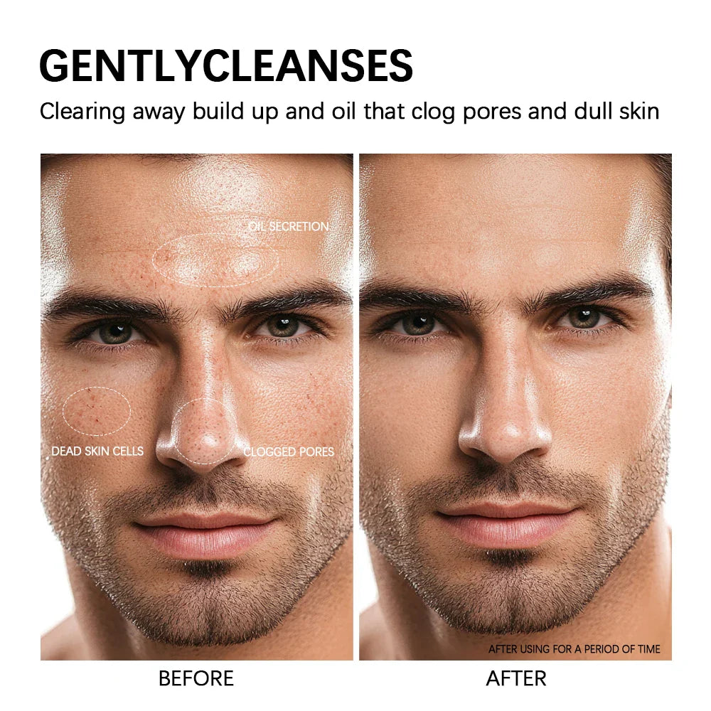 Glycolic Acid Clay Cleanser & Mask – Oil Control All Skin Types