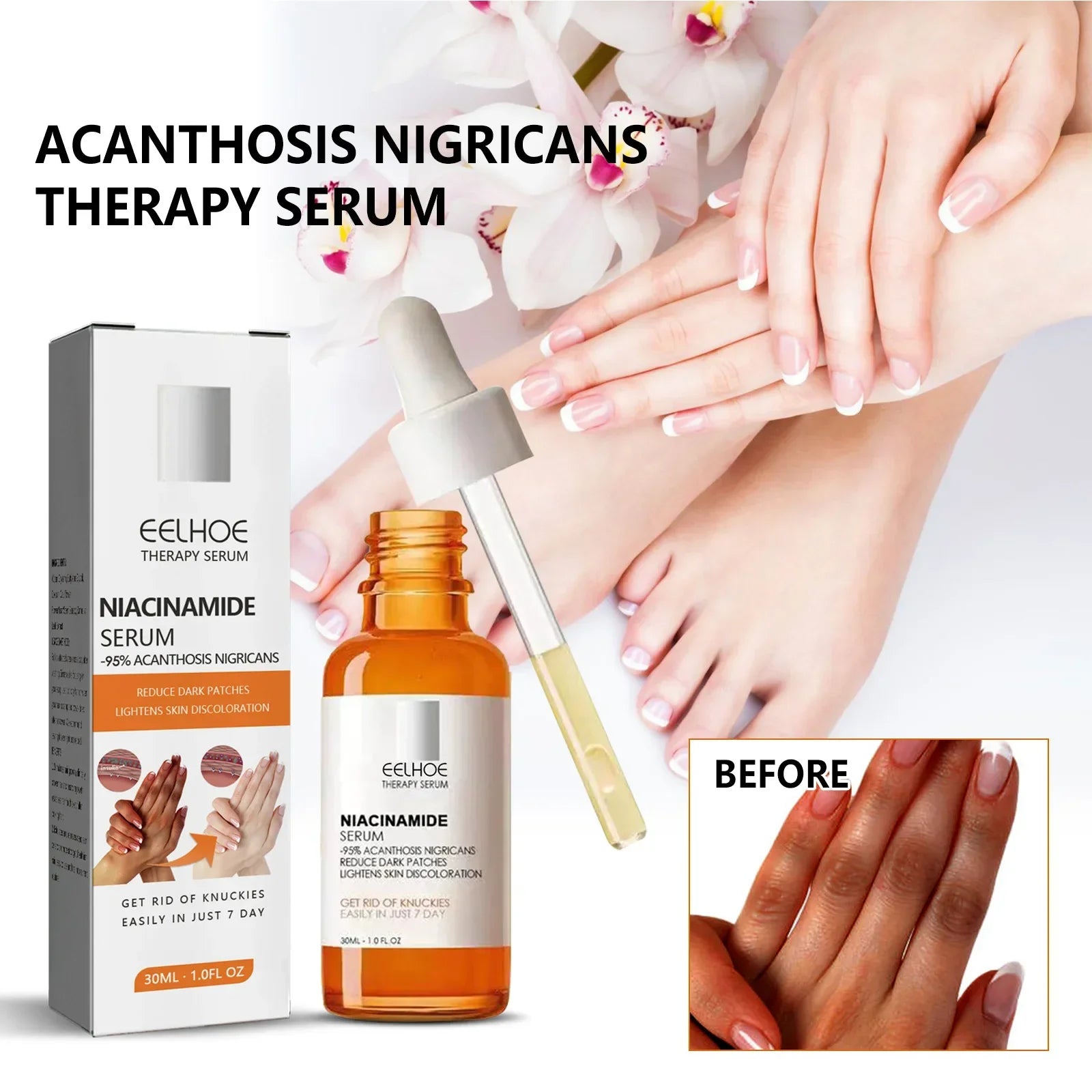 Dark Knuckles Whitening Serum Dark Knees Elbow Lightening Pigmentation Corrector Hand Knuckle Glow Intense Stains Remover Serum Peaceful Pleasures Health and Wellness