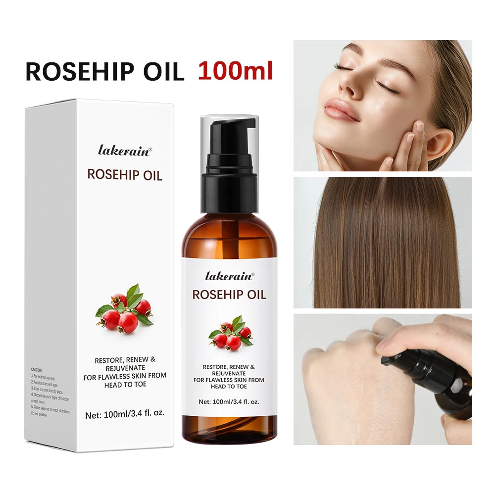 Organic Rosehip Oil 30ml – Anti-Aging Scar & Face Moisturizer Rosehip Face Oil Peaceful Pleasures Health and Wellness 1pc