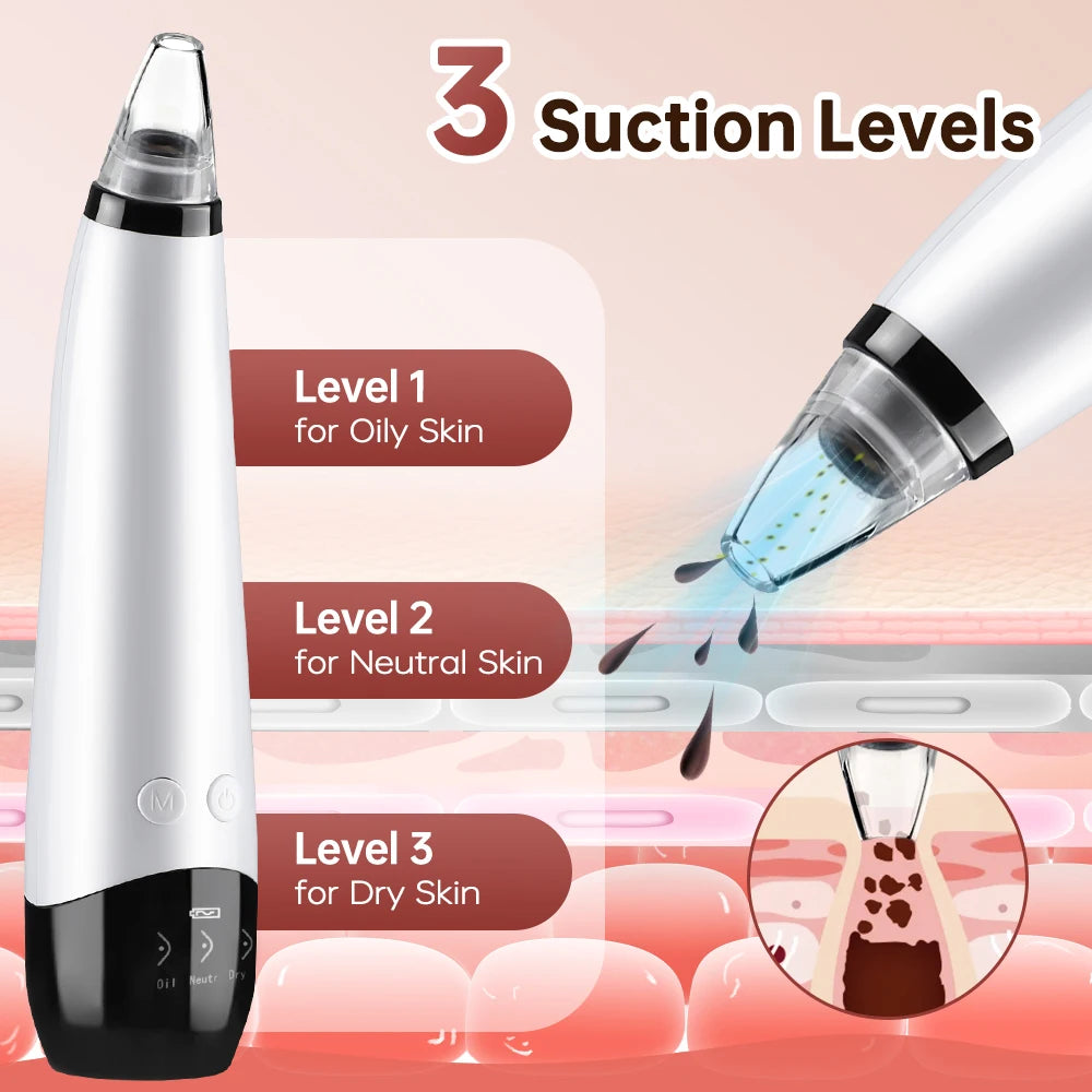 Blackhead Remover Facial Pore Cleaner 3 Suction Power Electric Pimple Acne Extractor Tool Face & Nose Whiteheads Vacuum Removal Peaceful Pleasures Health and Wellness