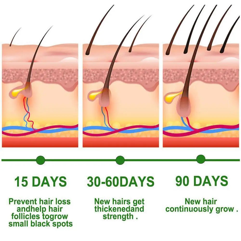 Rosemary Essential Oil for Hair Growth & Repair – 30ml