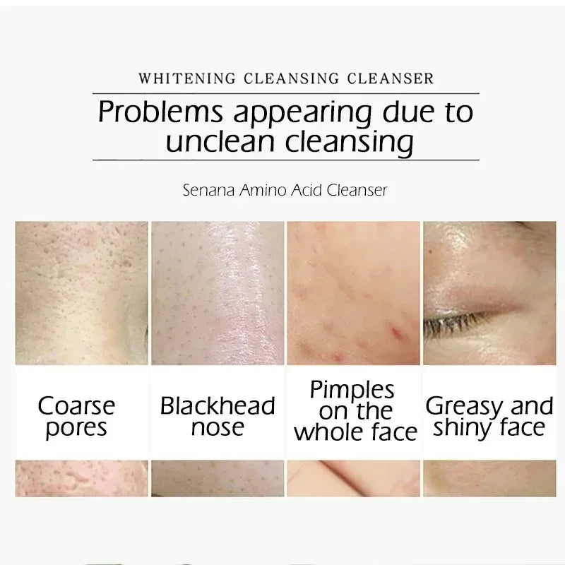 Nicotinamide Amino Acid Face Cleanser Facial Scrub Cleansing Acne Oil Control Blackhead Remover Shrink Pores Skin Care Peaceful Pleasures Health and Wellness