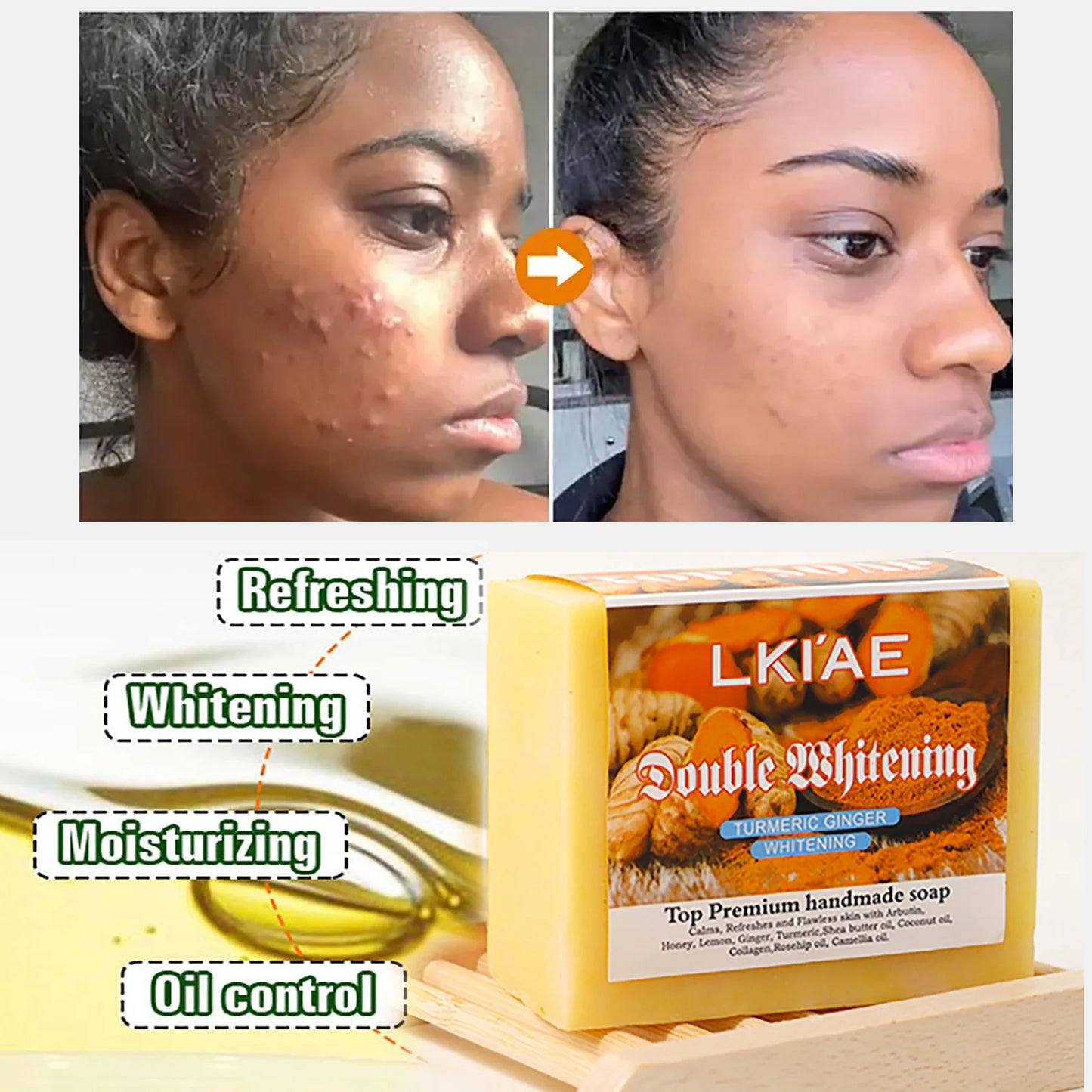 AILKE Turmeric Whitening Soap with Honey & Glycerin – 150g