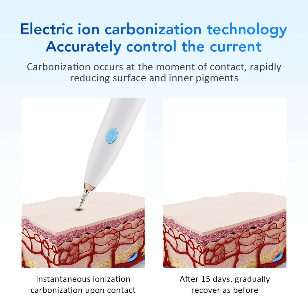 Mole Spot Scanning Removal Pen Beauty Plasma Pen Needle 9-speed Tattoo Removal Household Spot Face Wart Freckle Remover Machine Peaceful Pleasures Health and Wellness