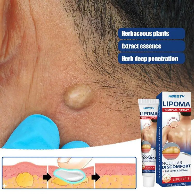 Herbal Skin Smoothing Cream – Fat Bulge & Lump Care 20g
