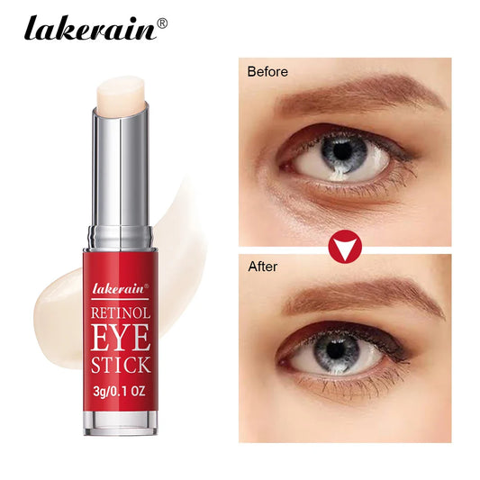 Lakerain Retinol Eye Cream – Firming, Brightening & Hydrating Retinol Eye Cream Oasis Select