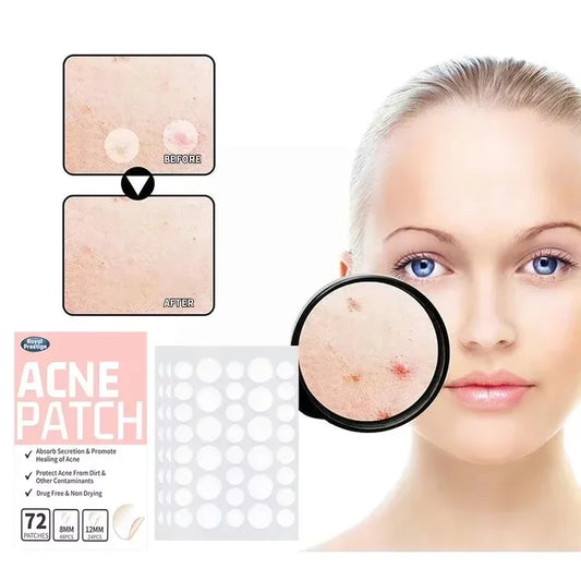Invisible Hydrocolloid Acne Patches 72/144pcs – Waterproof Pimple Hydrocolloid Acne Patch Peaceful Pleasures Health and Wellness