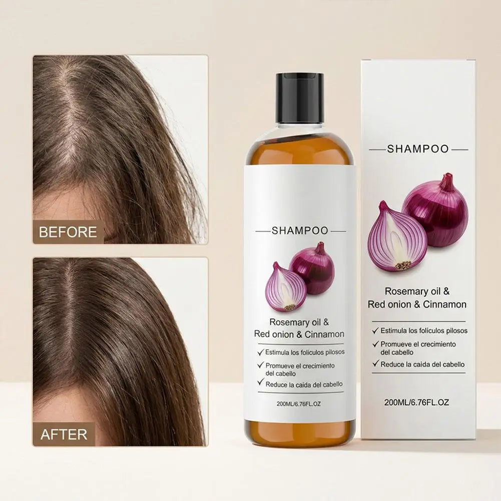 Rosemary Red Onion Shampoo/Conditioner Anti Hair Loss Promote Thicker Stronger excalvo Shampoo/Conditioner Hair Care Peaceful Pleasures Health and Wellness
