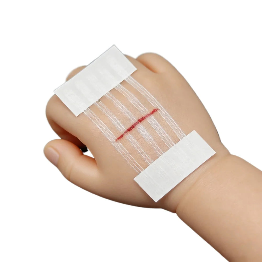 5 Strips Wound Skin Closure Strips Postpartum Wound Repair Cosmetic Surgery Strip Adhesive Medical Suture Free Surgical Tape Peaceful Pleasures Health and Wellness