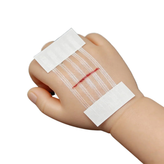 5 Strips Wound Skin Closure Strips Postpartum Wound Repair Cosmetic Surgery Strip Adhesive Medical Suture Free Surgical Tape Peaceful Pleasures Health and Wellness