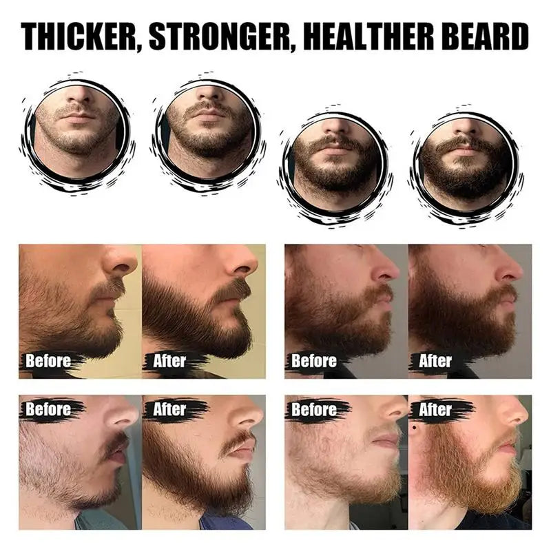 Eelhoe 5-Piece Beard Growth & Grooming Kit for Men