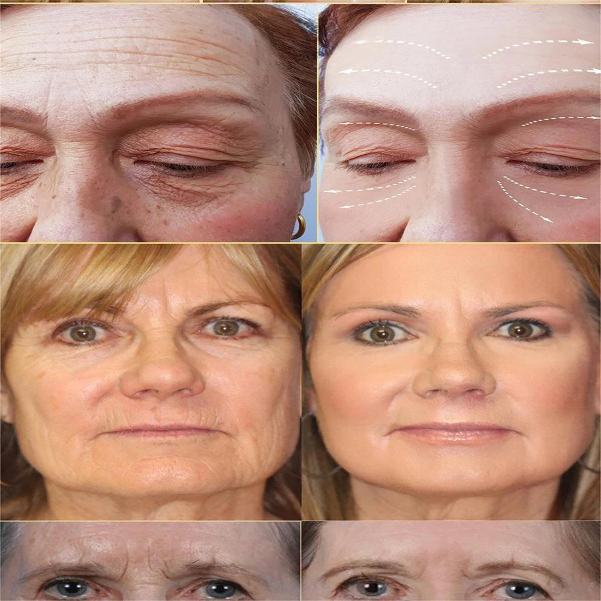 Facial Anti Wrinkle Serum Dark Spot Remover For Face Lifting Firming Essence Fade Fine Line Moisturizing Whitening Care Products Peaceful Pleasures Health and Wellness