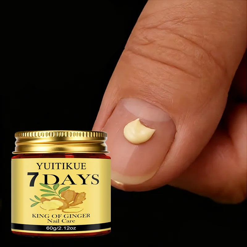 YUITIKUE Ginger King Nail Cream – 7-Day Nail Care, 60g Nail Treatment Cream Peaceful Pleasures Health and Wellness Default Title