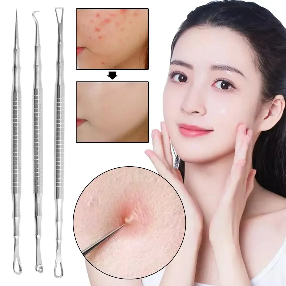 Stainless Steel Pimple Extractor & Blackhead Removal Tool Peaceful Pleasures Health and Wellness