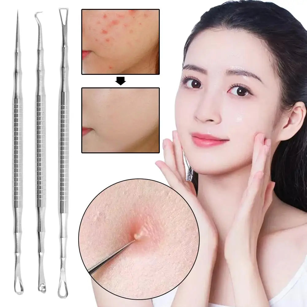 Stainless Steel Blackhead & Pimple Extractor Tool