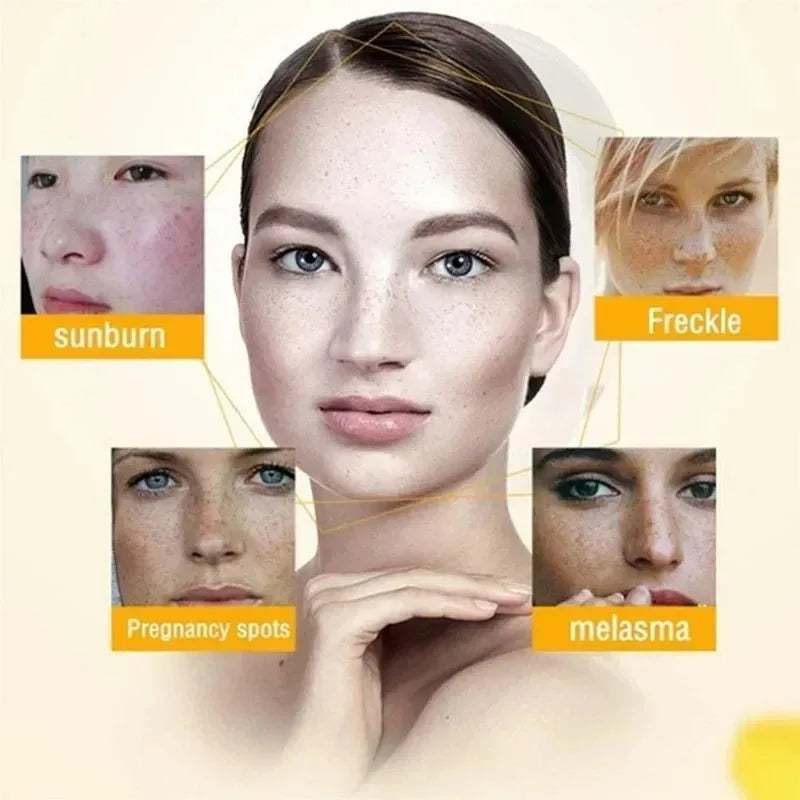 Niacinamide Whitening Freckle Cream – Dark Spot Fader Peaceful Pleasures Health and Wellness