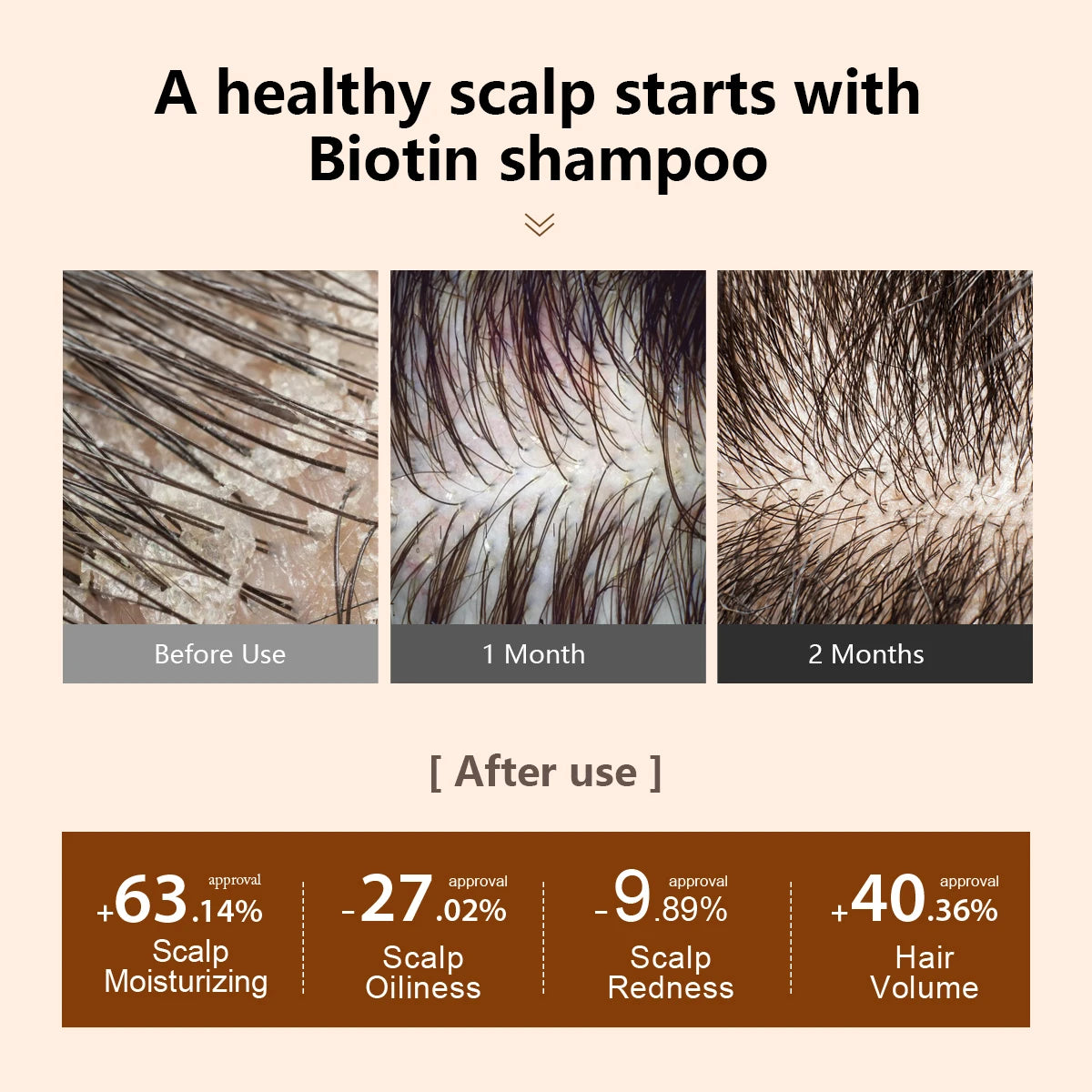 Biotin Prevent Hair Loss Shampoo And Conditioner Growth Oil Treatment For Hair Fast Regrowth Care Beard Hair Beauty Health Care Peaceful Pleasures Health and Wellness