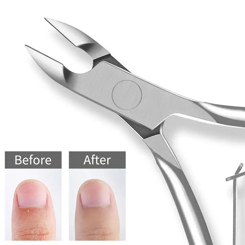 Stainless Steel Cuticle Nipper | Dead Skin & Nail Trimmer