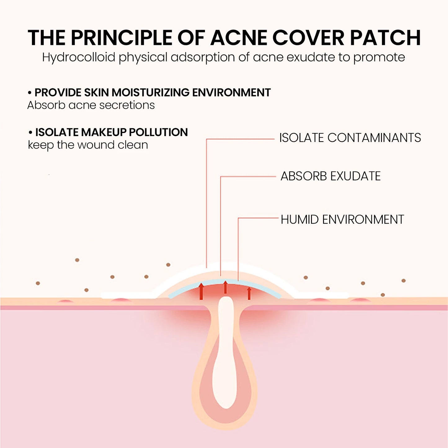 200-Pc Star Hydrocolloid Acne Pimple Patches – Fade Blemishes