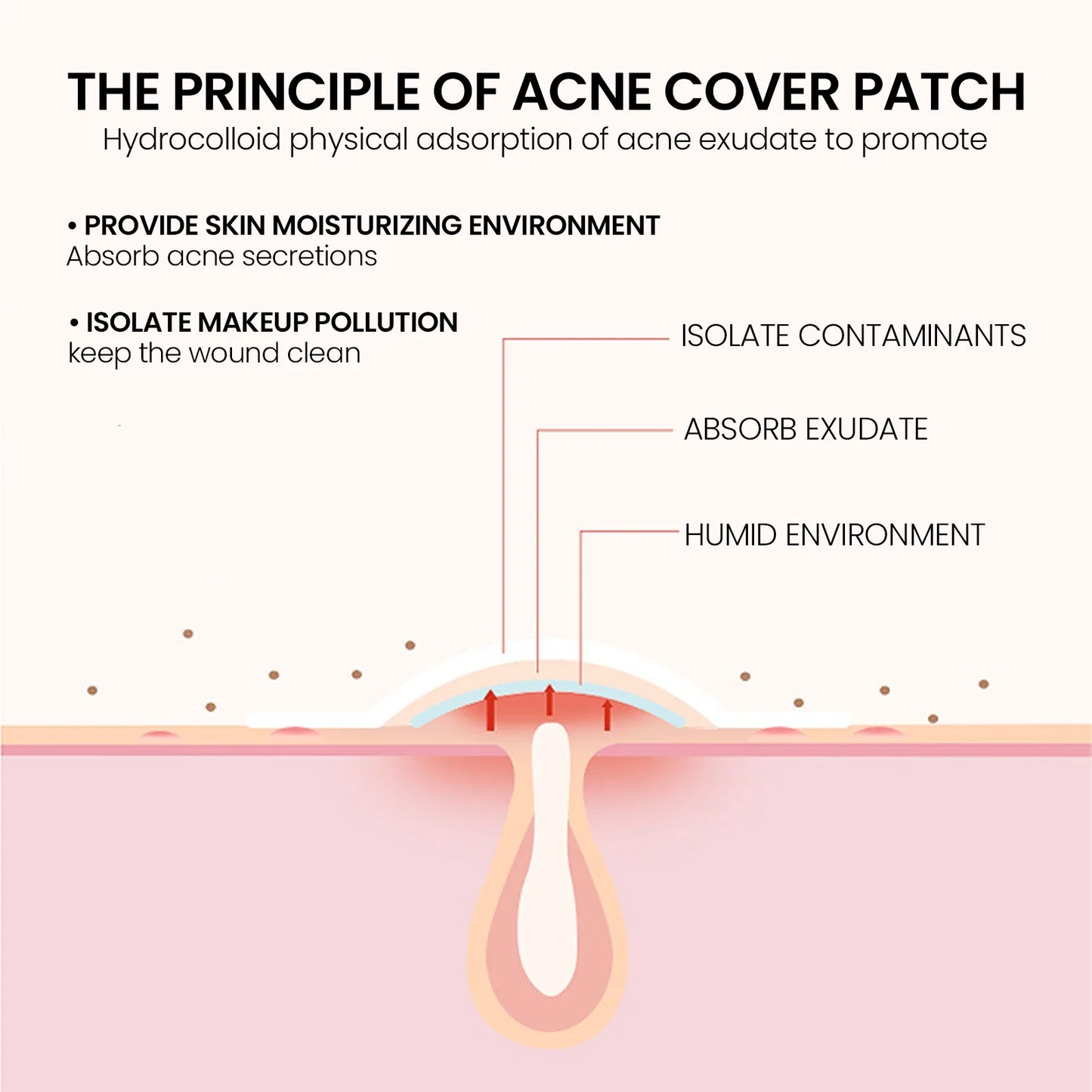200-Pack Star Hydrocolloid Acne Patches – Fade Blemishes Fast