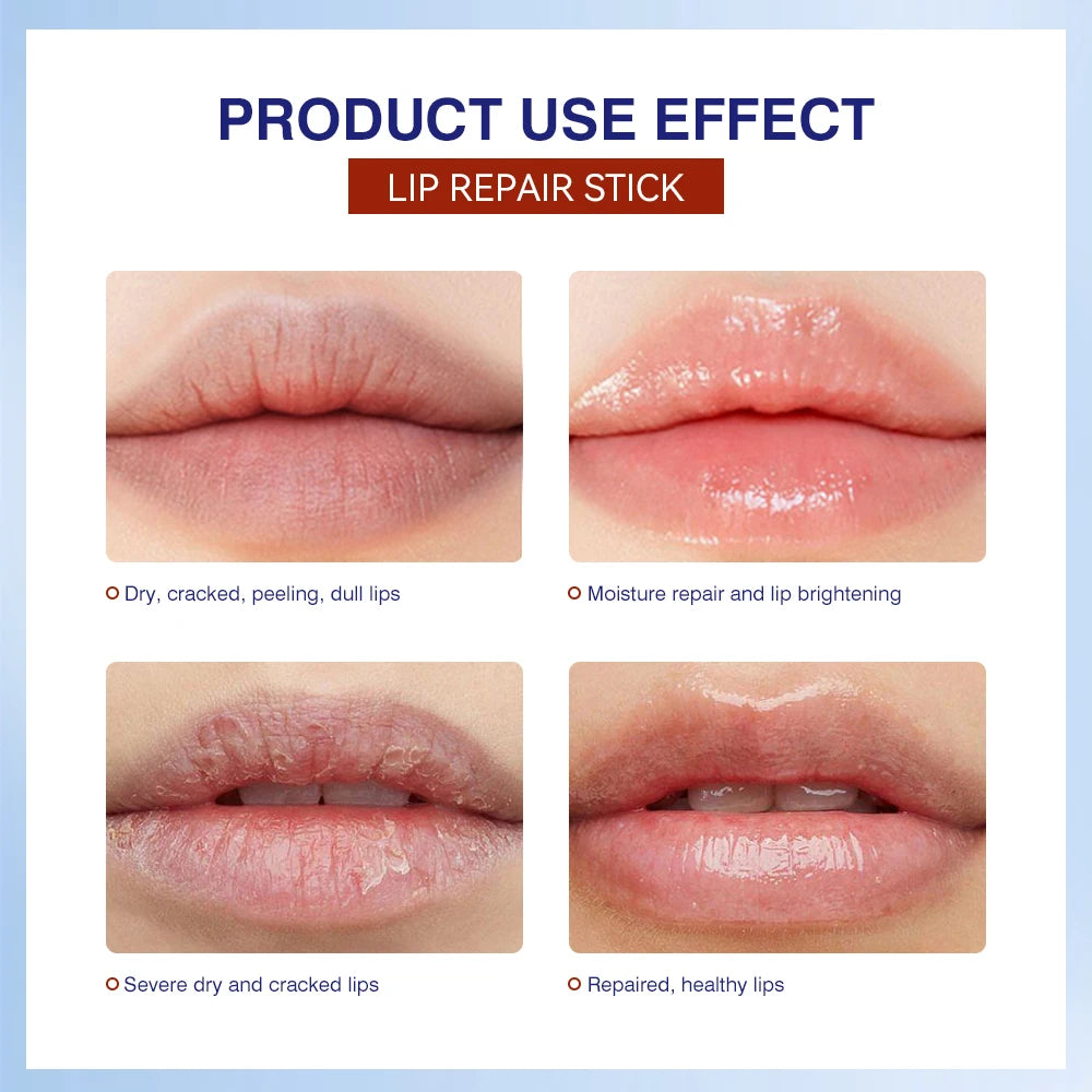 Lakerain Lip Repair Stick 2 Packs Quick Relief Of Dry Moisturizing And Smoothing lip Lines Lip Balm Soothes Chapping Lipstick Peaceful Pleasures Health and Wellness