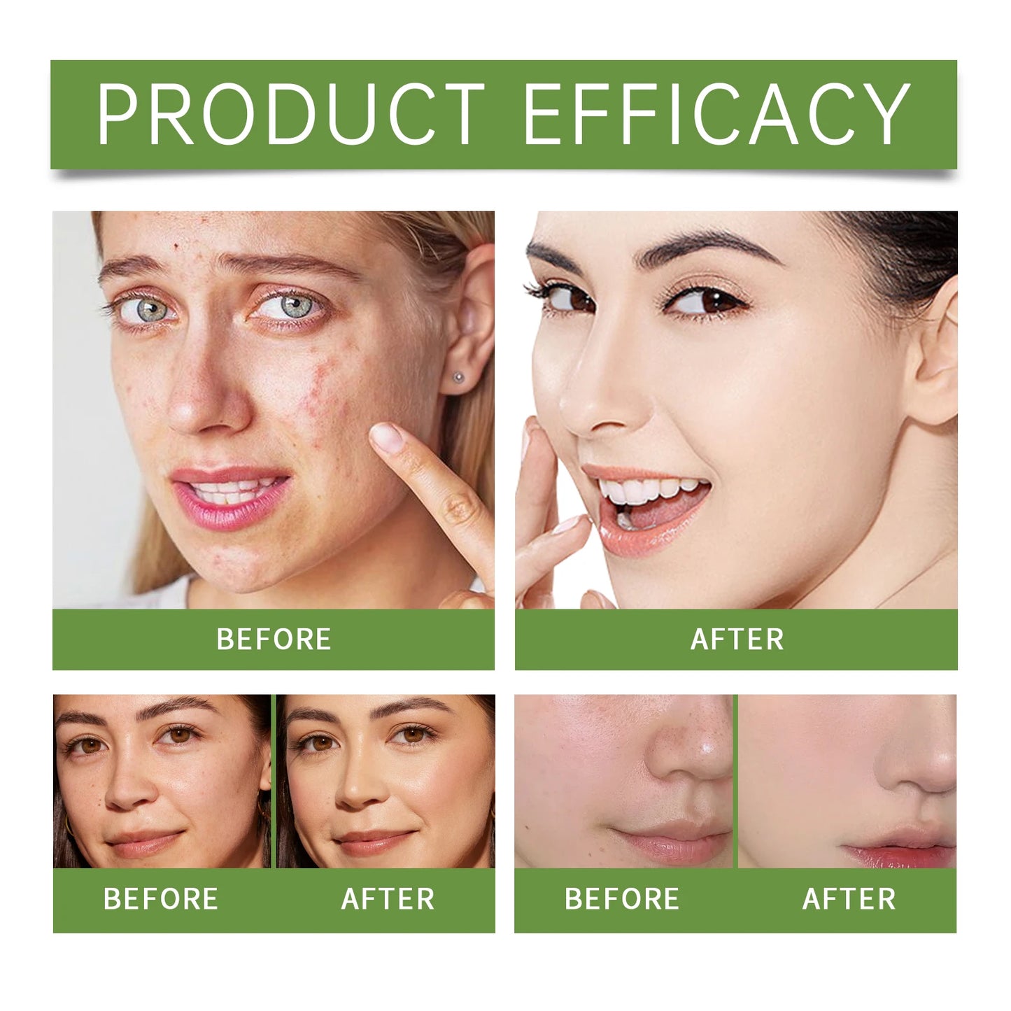 Aloe Vera Daily Face Cream – Anti-Aging Oil-Free Moisturizer