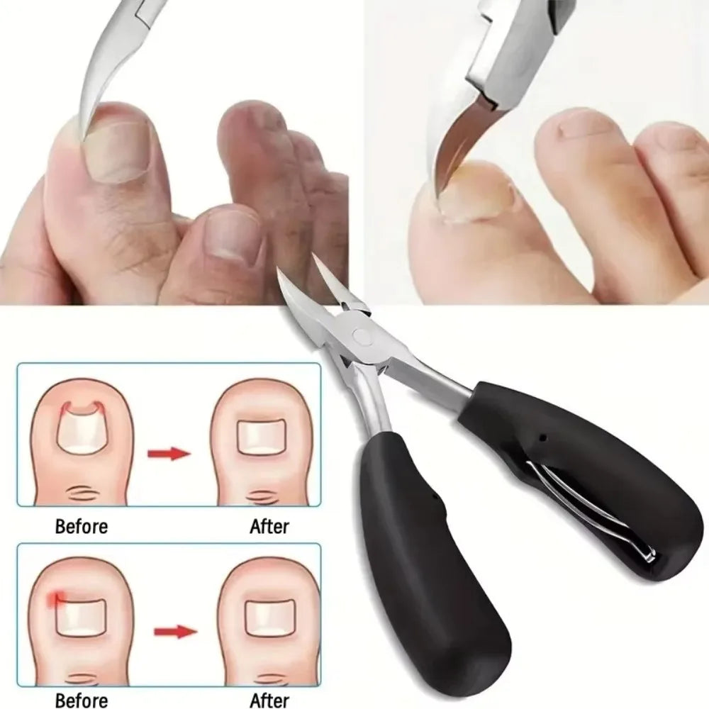 Professional Toenail Clippers – Curved Blade Nail & Skin Tool