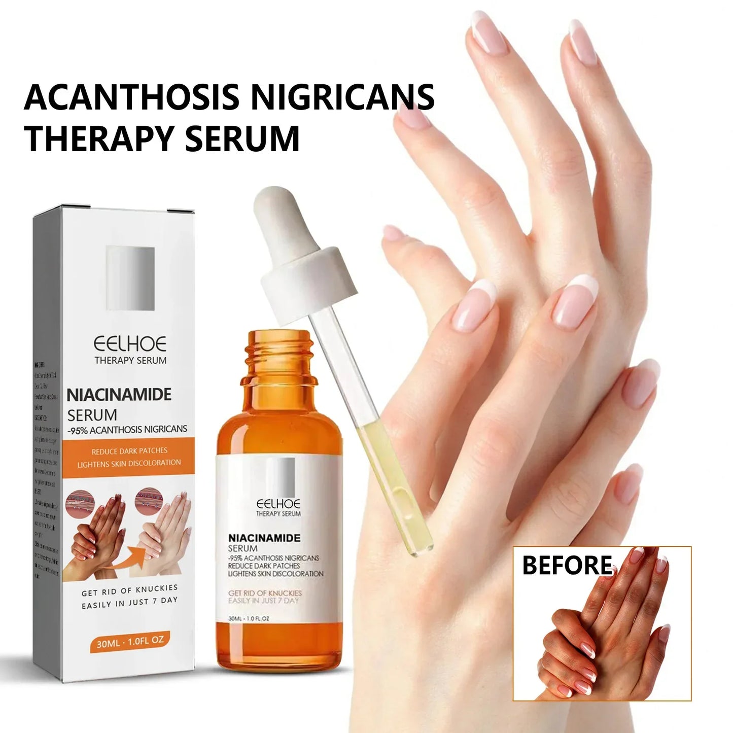 Dark Knuckles Whitening Serum Dark Knees Elbow Lightening Pigmentation Corrector Hand Knuckle Glow Intense Stains Remover Serum Peaceful Pleasures Health and Wellness
