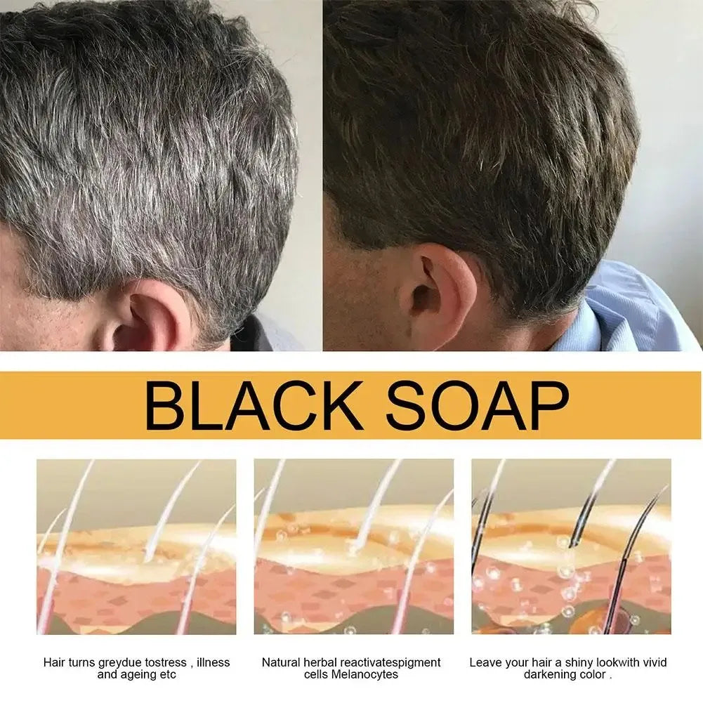 1/3pcs Polygonum Multiflorum Black Hair Soap White Hair Repair Soap Hair Care Nourishing Anti Dandruff Natural Hair Dye Soap Peaceful Pleasures Health and Wellness