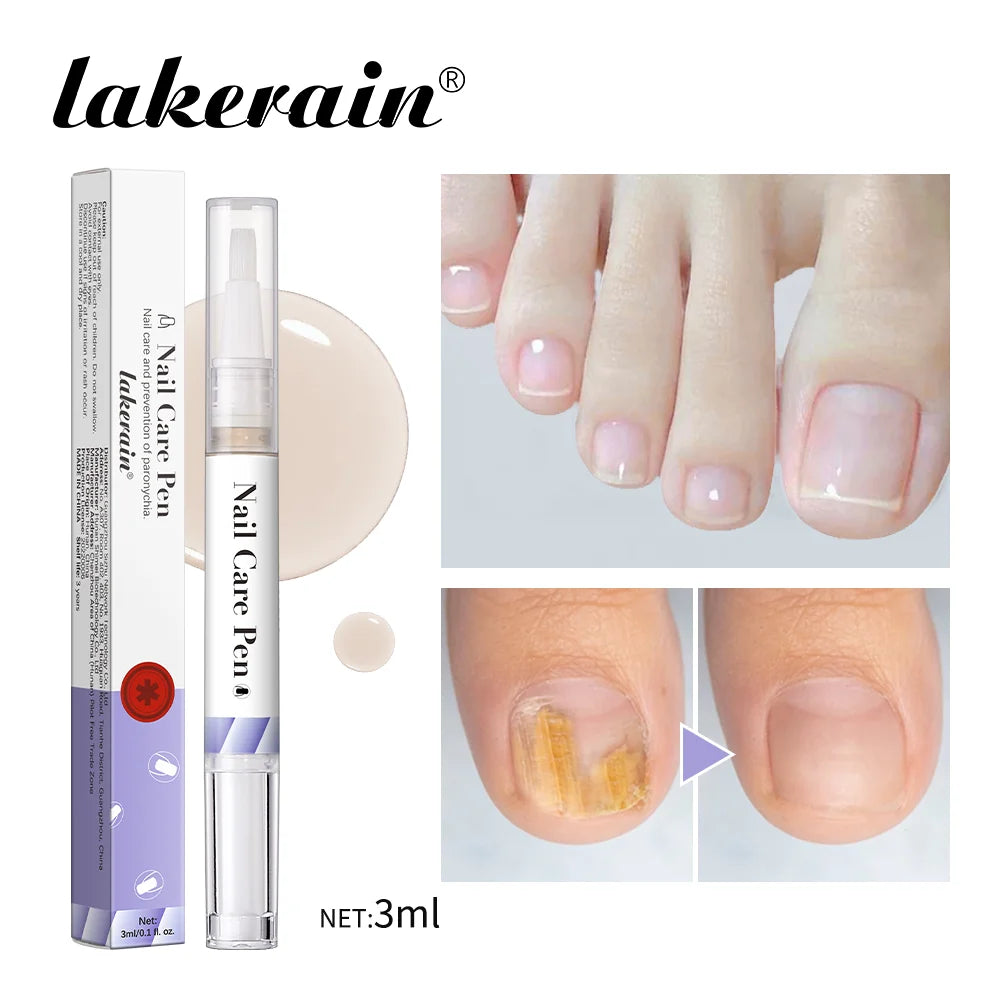 Nail Care Pen Nourish and Moisturize Nails Prevent Fungal Infections Improve Appearance Flat Brush Head Design Daily Nail Care Peaceful Pleasures Health and Wellness Purple