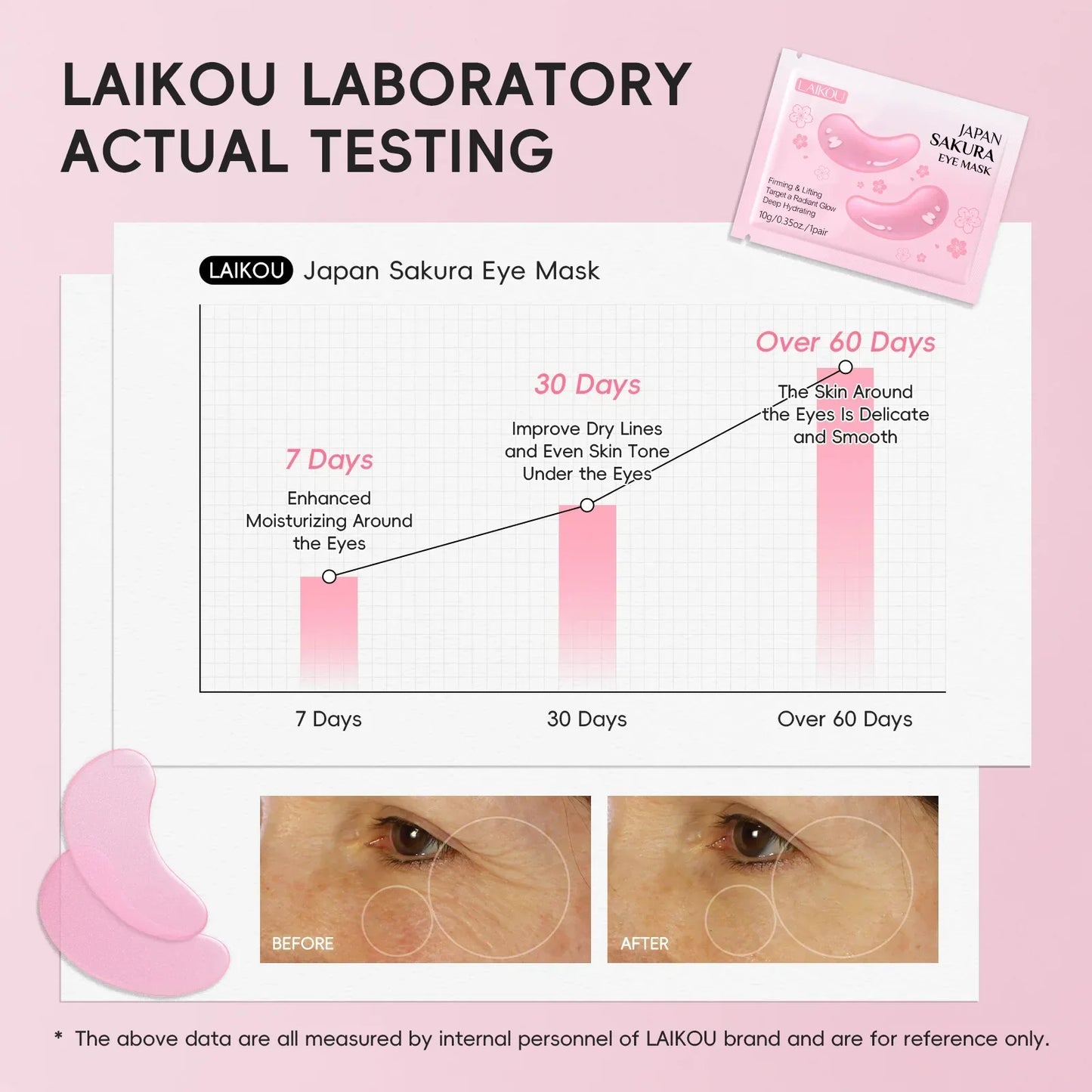 5/10 PCS LAIKOU Eye Mask Anti Dark Circles Removal Eyes Bags Moisturizing Firming Eye Patches Eyes Skin Care Products Peaceful Pleasures Health and Wellness