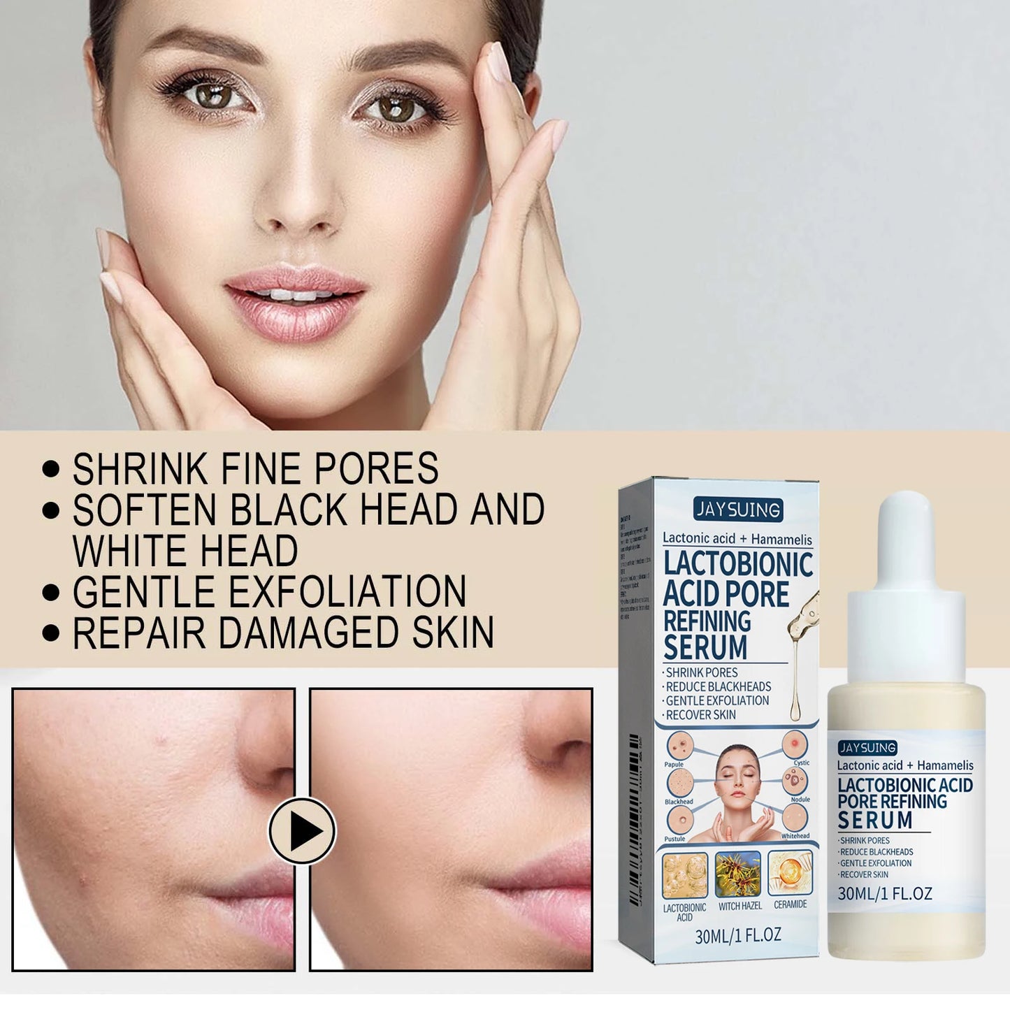 Lactic Acid Essence – Blackhead Removal & Pore Tightening Serum