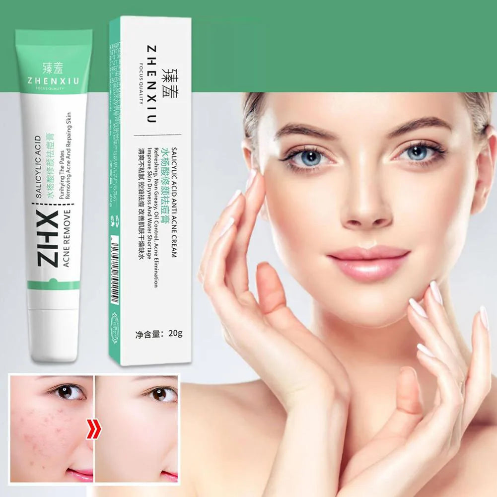 20g Salicylic Acid Shrink Pore Cream Elimination Large Pores Remove Blackehead Face Smooth Repairing Skin Care Product Peaceful Pleasures Health and Wellness