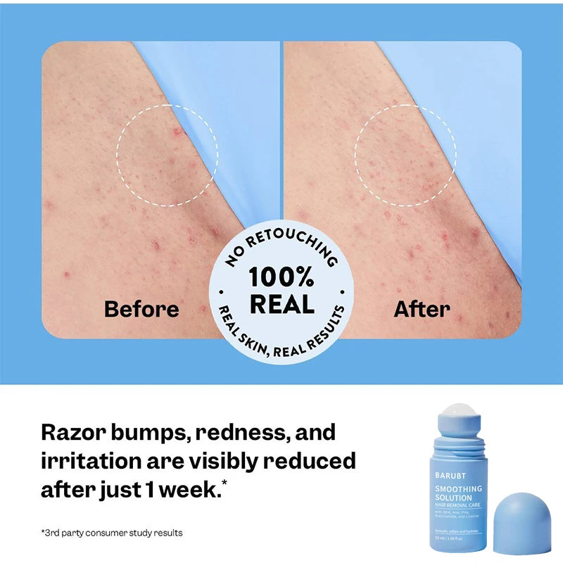 Hair Removal Soothing Essence Moisturizer Gentle Repair Lasting Refresh Deep Nourishing Lubricat Skin Rejuvenation Rolleressence Peaceful Pleasures Health and Wellness