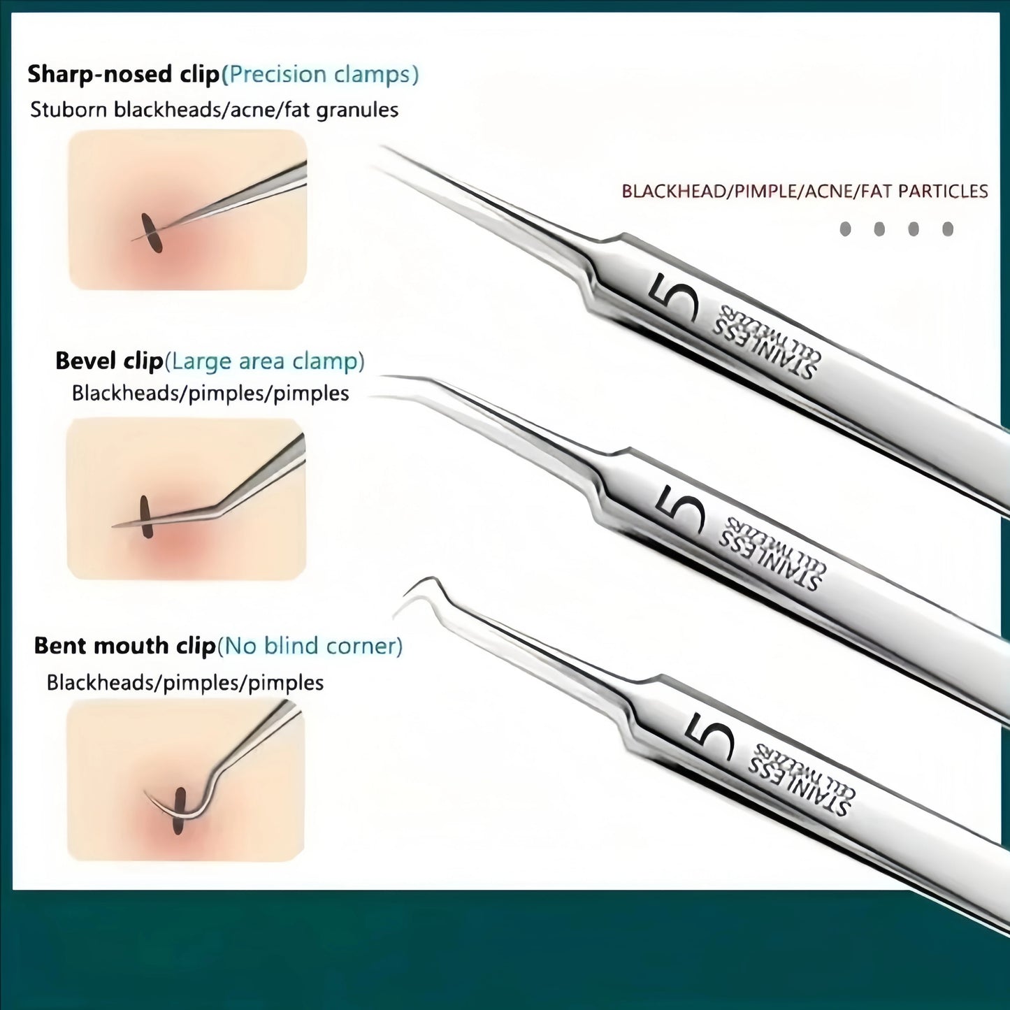 8-Piece Stainless Steel Blackhead Extraction Tool Kit