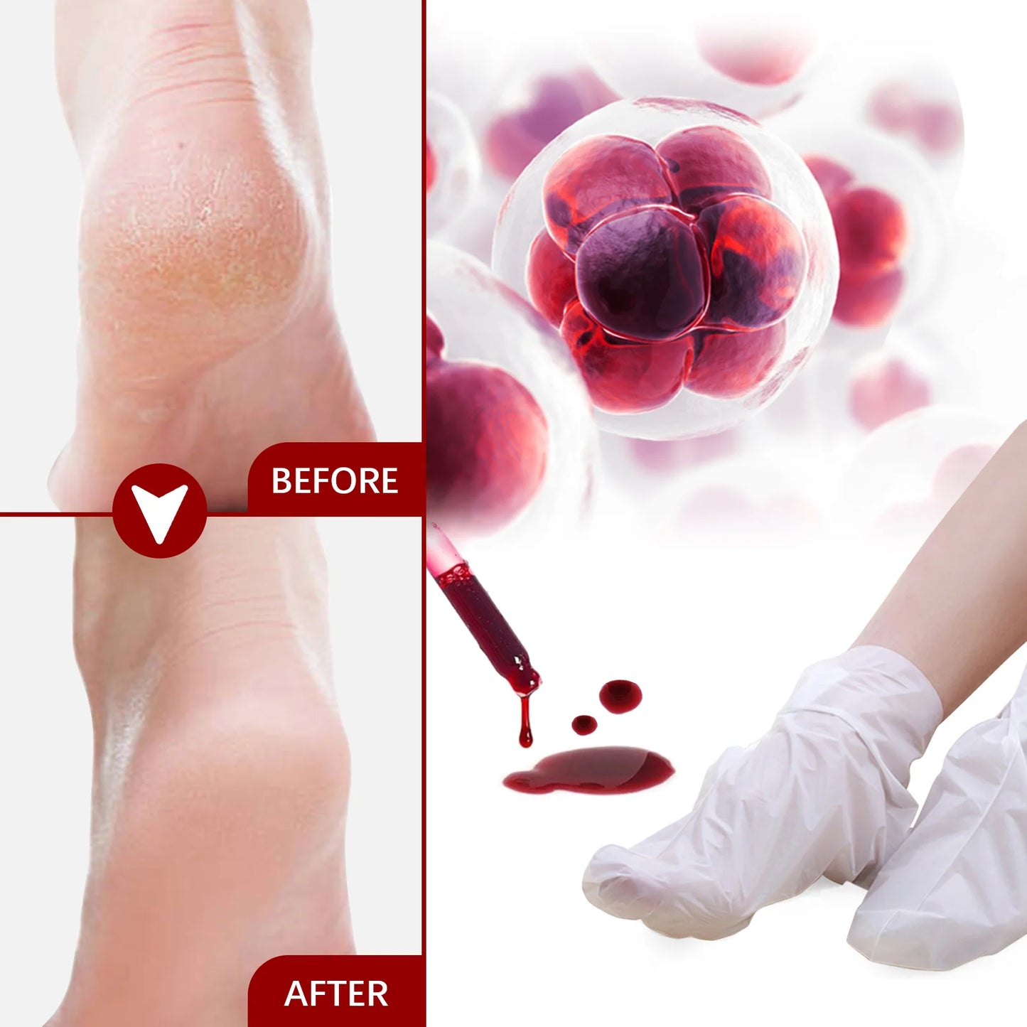 AHA Exfoliating Foot Mask – Callus & Dead Skin Remover