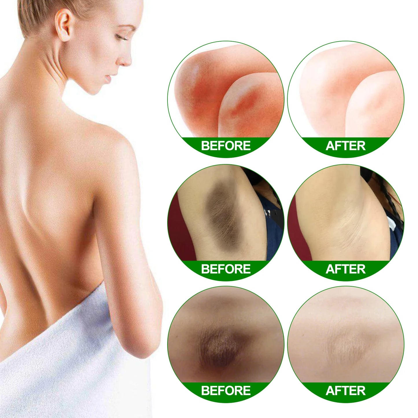 Retinol Body Brightening Cream – Knees, Underarms & Dark Spots