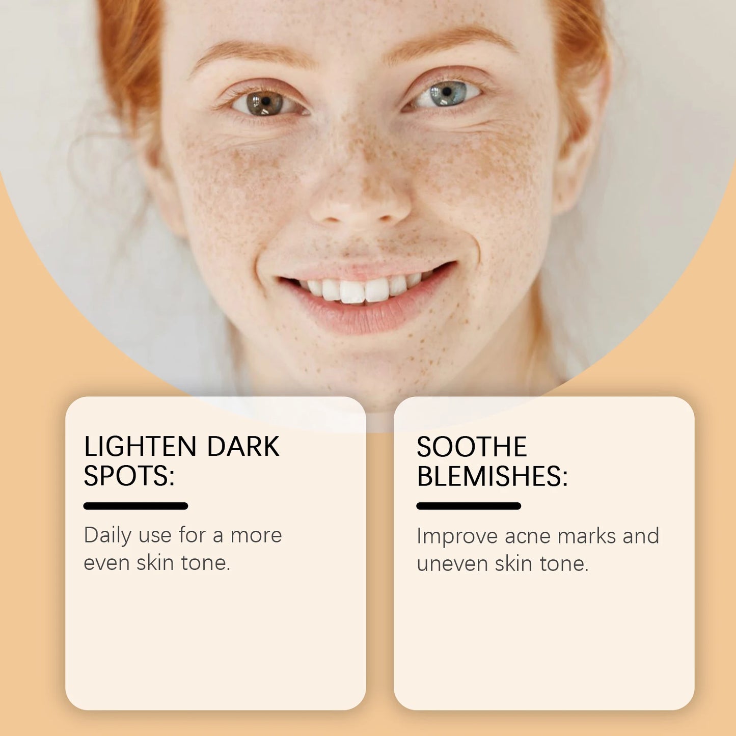 HOYGI Dark Spots Remover Cream Anti Acne Anti Pigmentation Even Skin Tone Reduce Melanin Nourishing Repair Damaged Skin Care 50g Peaceful Pleasures Health and Wellness
