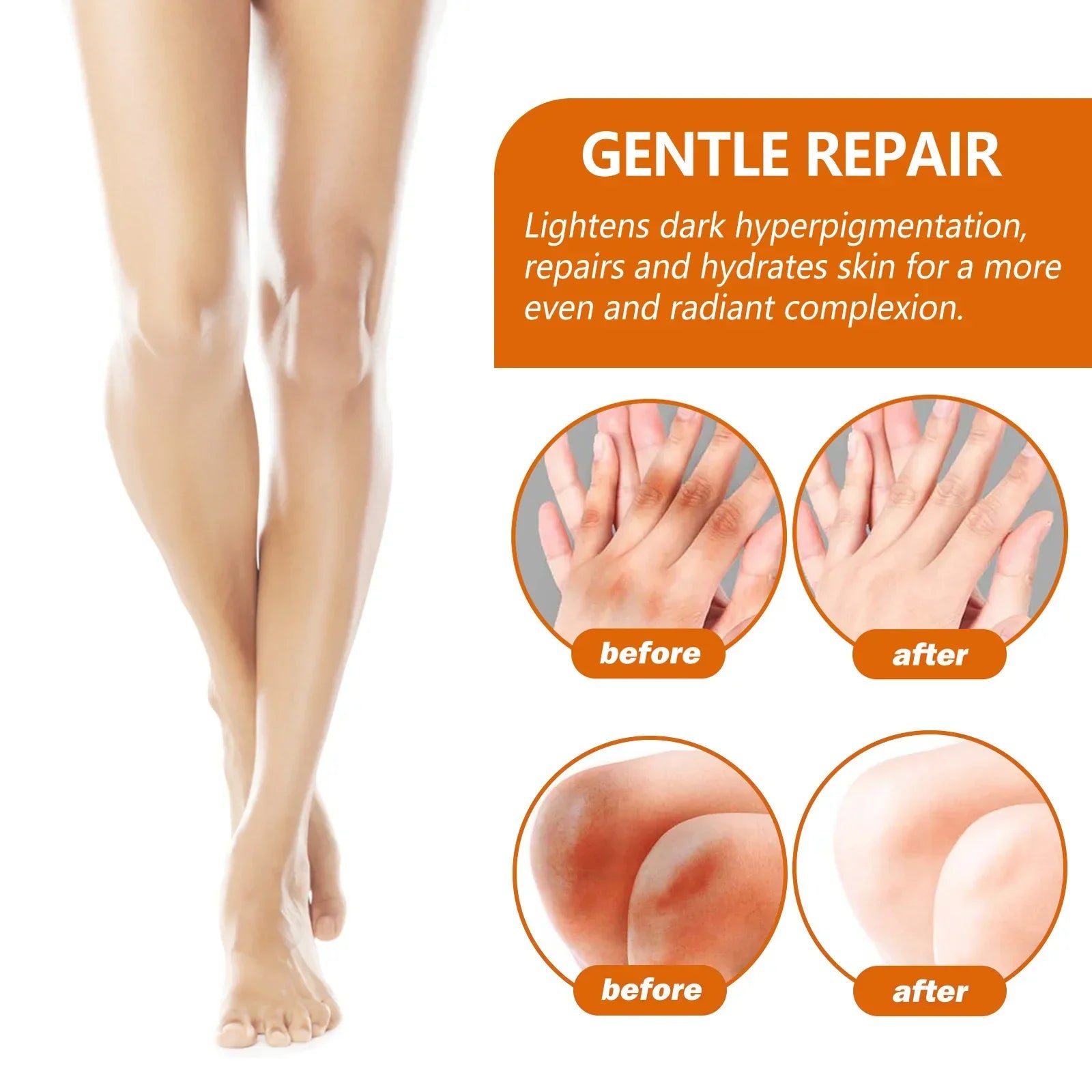 Dark Knuckles Whitening Serum Dark Knees Elbow Lightening Pigmentation Corrector Hand Knuckle Glow Intense Stains Remover Serum Peaceful Pleasures Health and Wellness