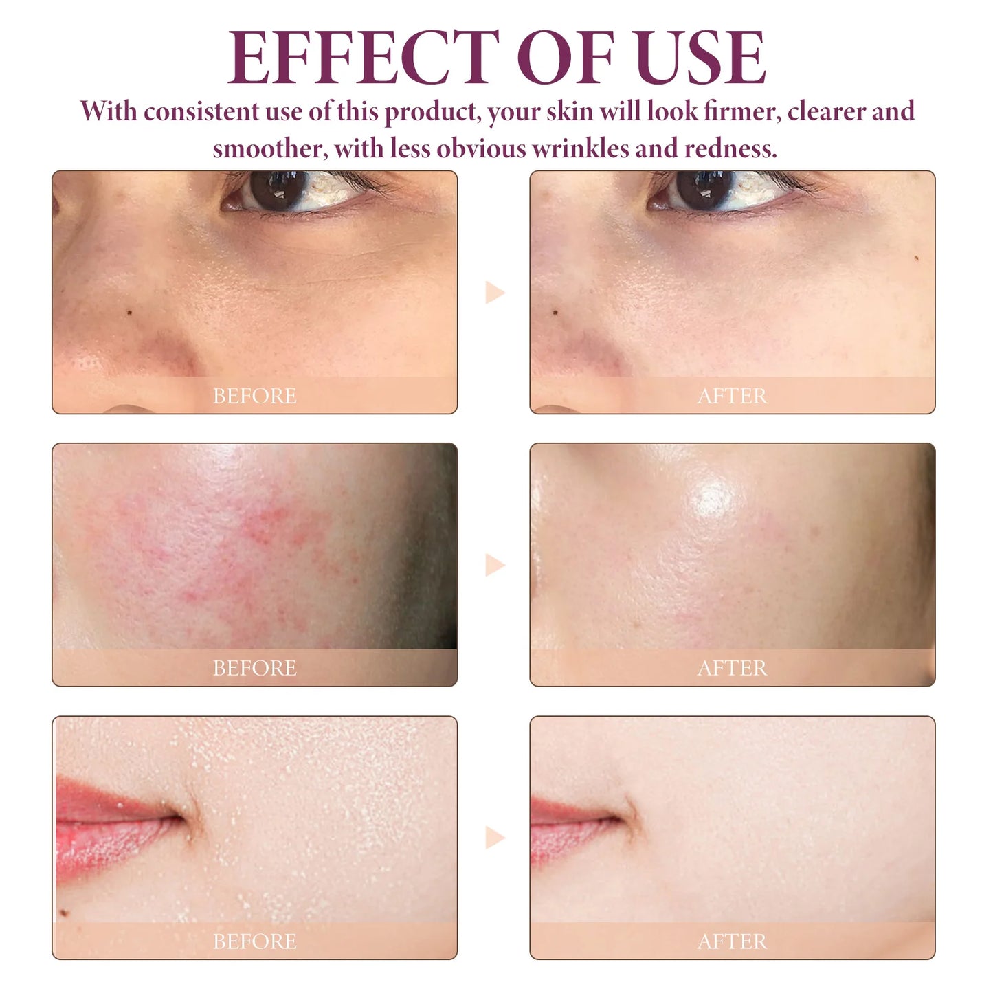 OceAura Glycolic Acid 10% Face Serum | AHA BHA Toning